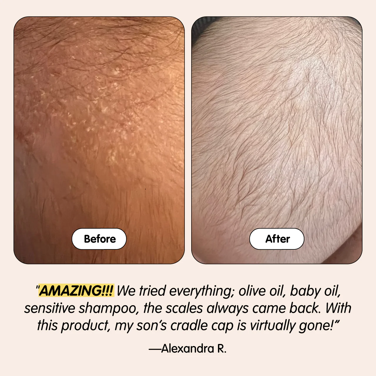 Bye-Bye Cradle Cap - Image 7